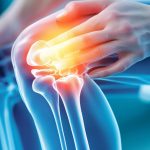 Soulager l&rsquo;arthrose et l&rsquo;arthrite